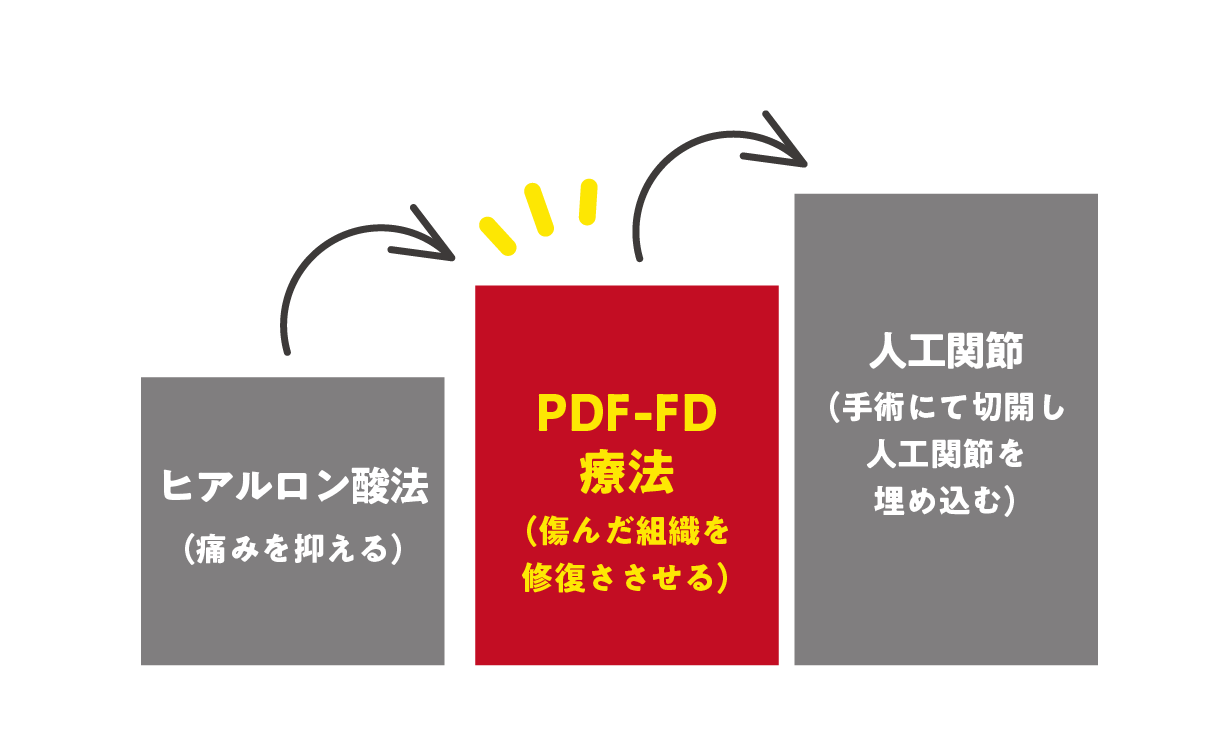 PDF-FD療法とは?